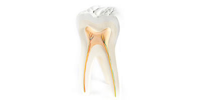 te-awamutu-painless_rootcanal-1